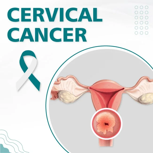 Cervical Cancer Prevention